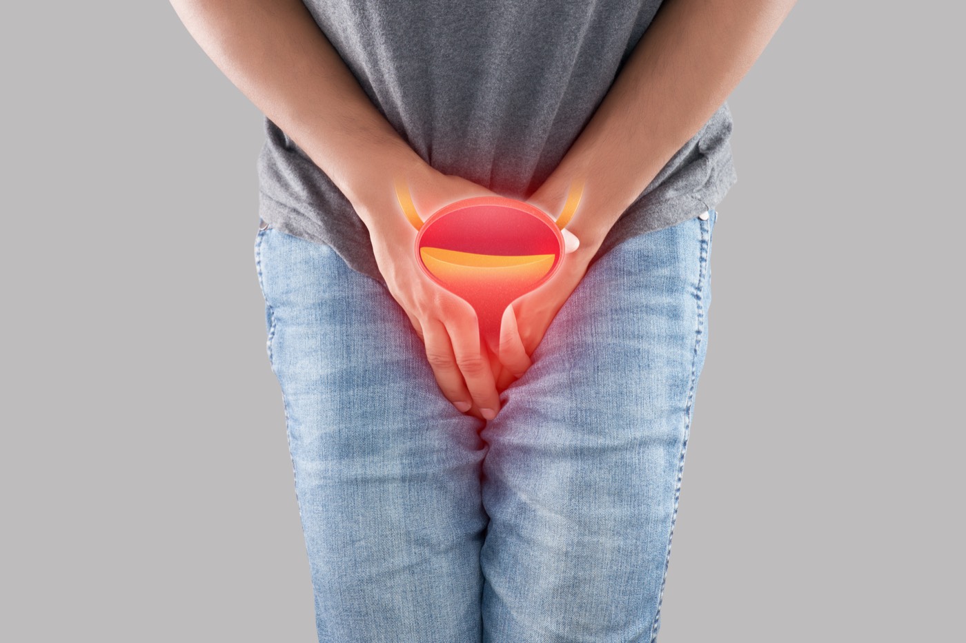 Urinary Tract Fistulae