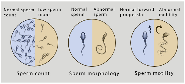 Semen Analysis