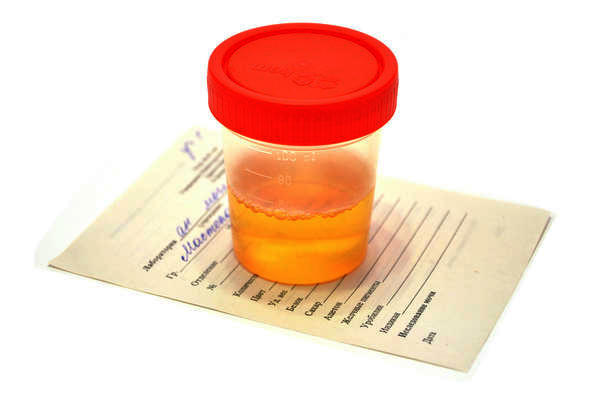 What is Blood in the Urine?